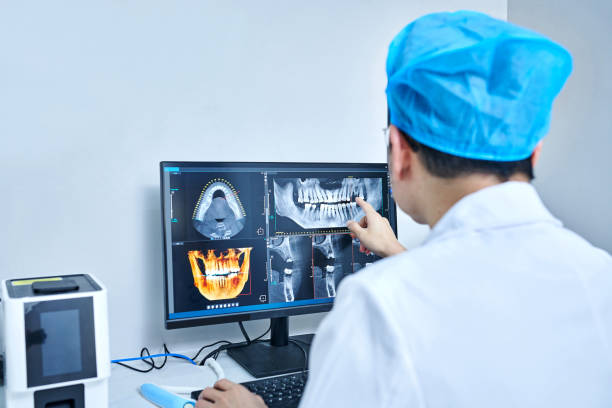 Best Emergency Tooth Extraction in Portola, CA